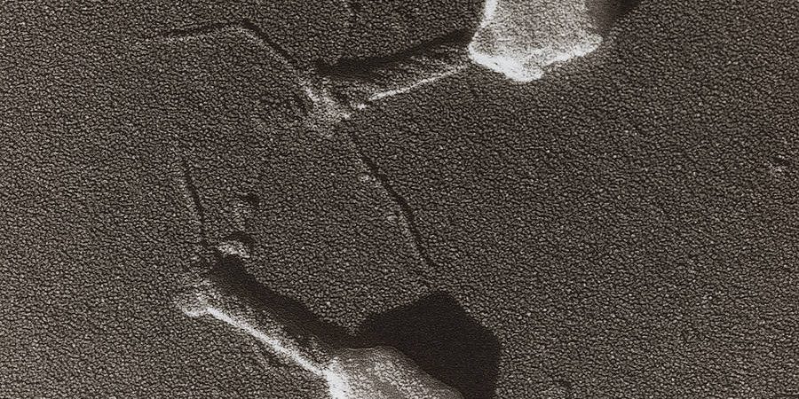 bacteriophage hig res