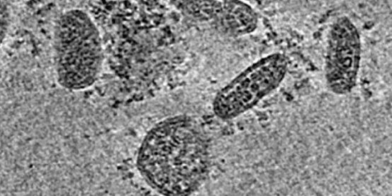 electron cryotomography coroni (1)